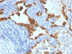Cytokeratin 8/18 Antibody (SPM192 + SPM265) - Azide and BSA Free, Novus Biologicals 100 &mu;g | Buy Online | Novus Biologicals | Fisher Scientific